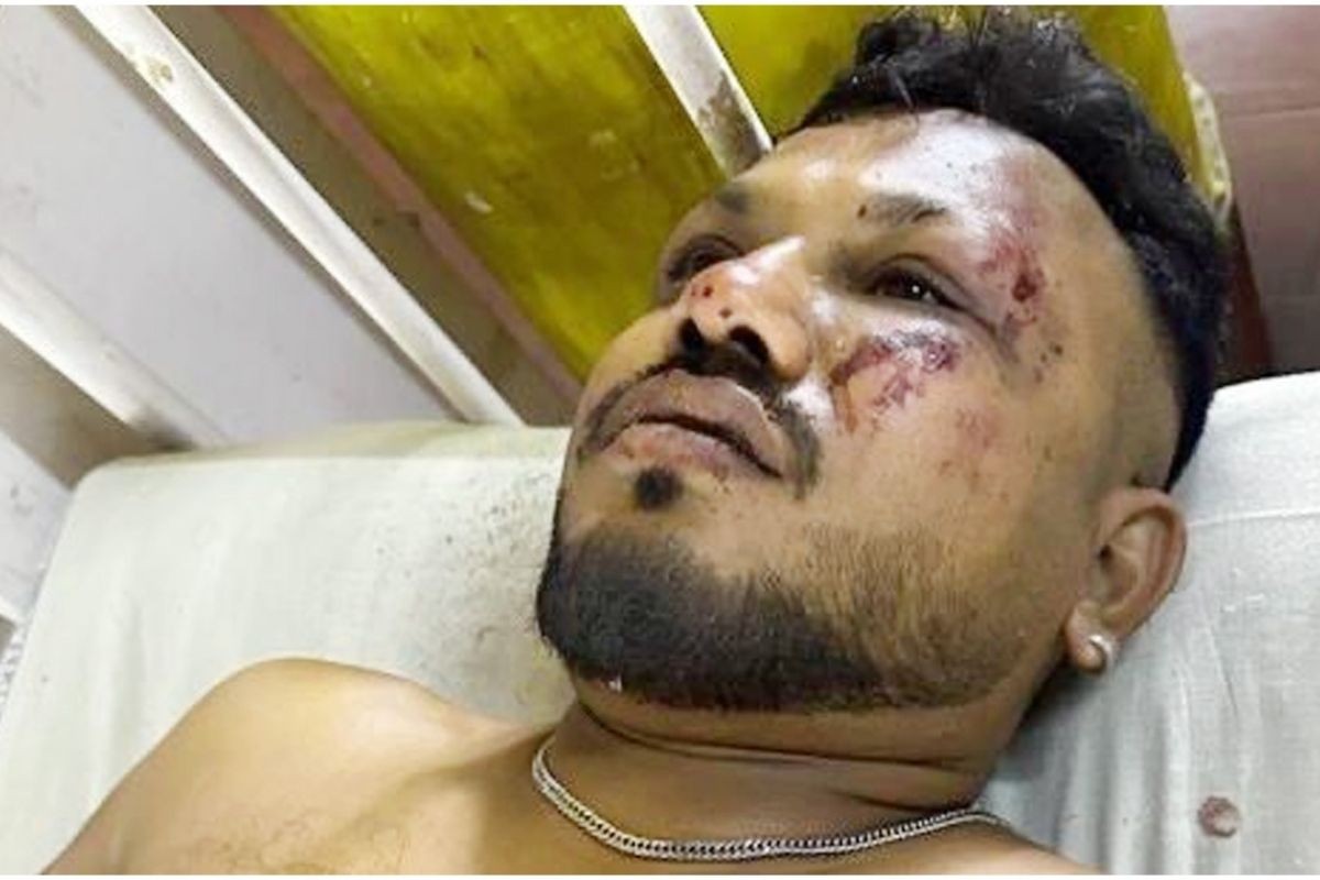 বিমান বিধ্বস্তে ২৪১ জন নিহত, অলৌকিকভাবে বেঁচে গেলেন এক যুবক