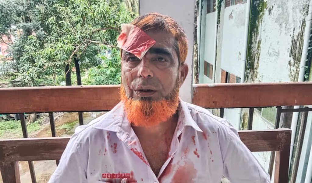 আদালতের ফটকে হত্যা মামলার সাক্ষীকে হাতুড়িপেটা করল আসামিরা 4 আদালতের ফটকে হত্যা মামলার সাক্ষীকে হাতুড়িপেটা করল আসামিরা 1753623220 আদালতের ফটকে হত্যা মামলার সাক্ষীকে হাতুড়িপেটা করল আসামিরা