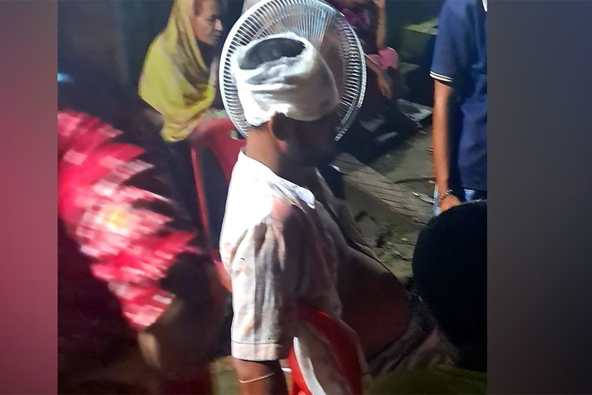 চাঁদা না দেওয়ায় প্রবাসীকে কুপিয়ে জখমের অভিযোগ বিএনপি নেতার বিরুদ্ধে