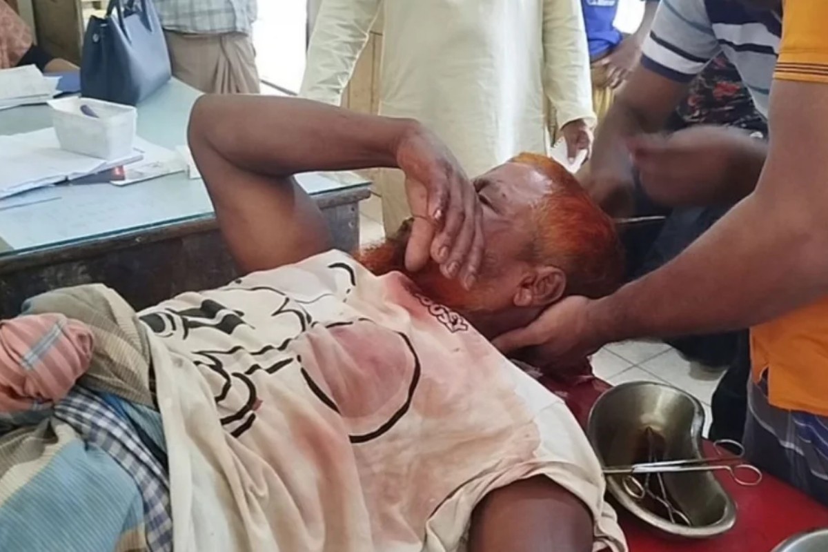 গুলিবিদ্ধ
