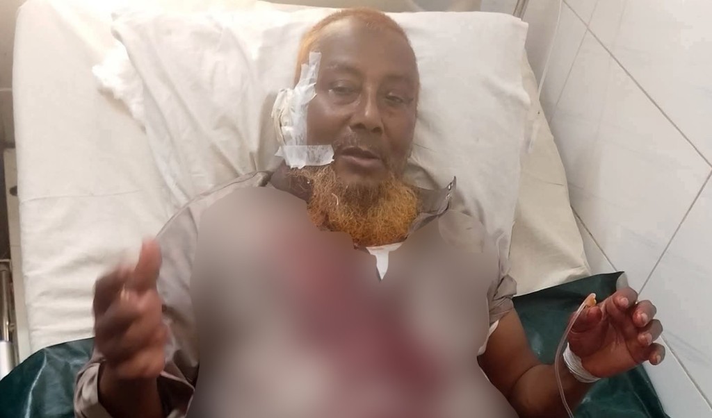 জুমা’র নামাজ শেষে মসজিদের ভিতরে ইমামকে কুপিয়ে জখম, আটক ১ 3 জুমার নামাজ শেষে মসজিদের ভিতরে ইমামকে কুপিয়ে জখম আটক ১ 1752241041 জুমা’র নামাজ শেষে মসজিদের ভিতরে ইমামকে কুপিয়ে জখম, আটক ১