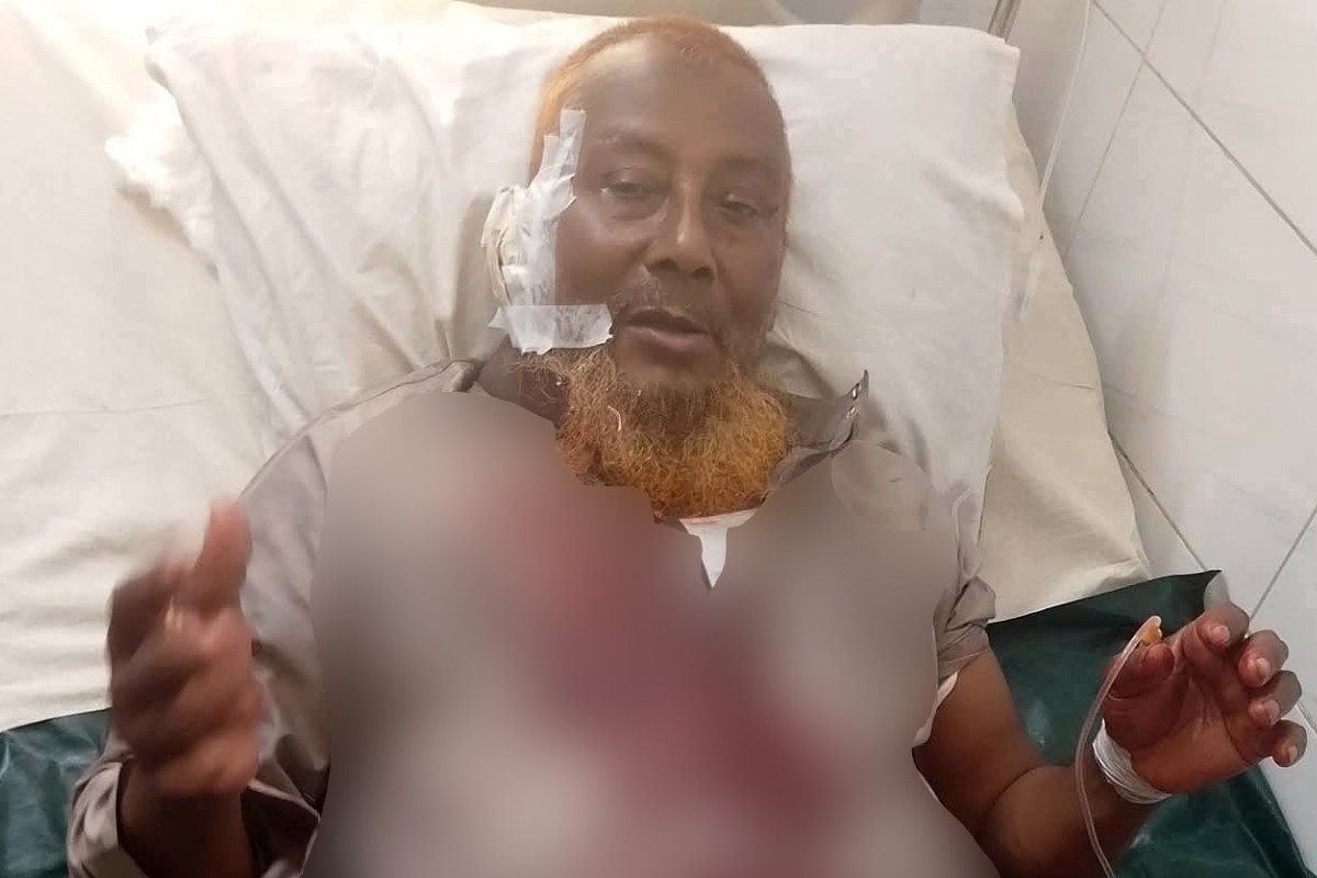 জুমা’র নামাজ শেষে মসজিদের ভিতরে ইমামকে কুপিয়ে জখম, আটক ১