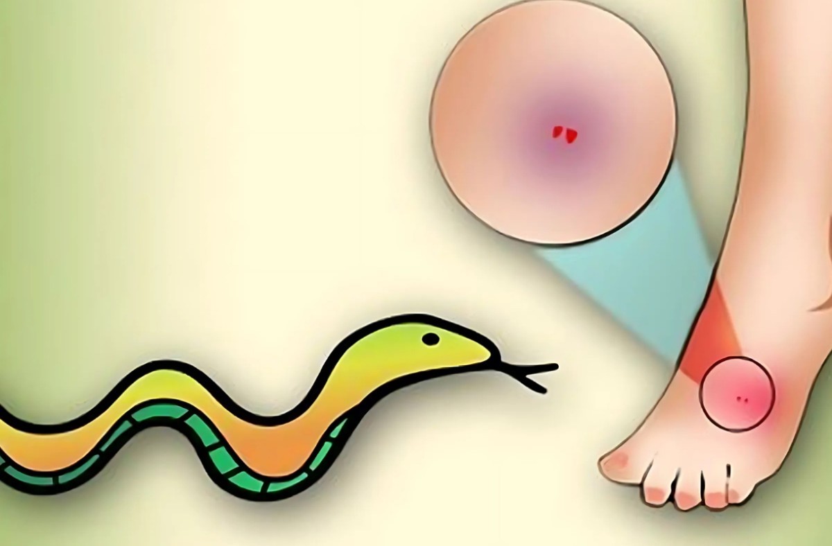 সাপের কামড়ে প্রাণ গেলো স্কুলছাত্রের