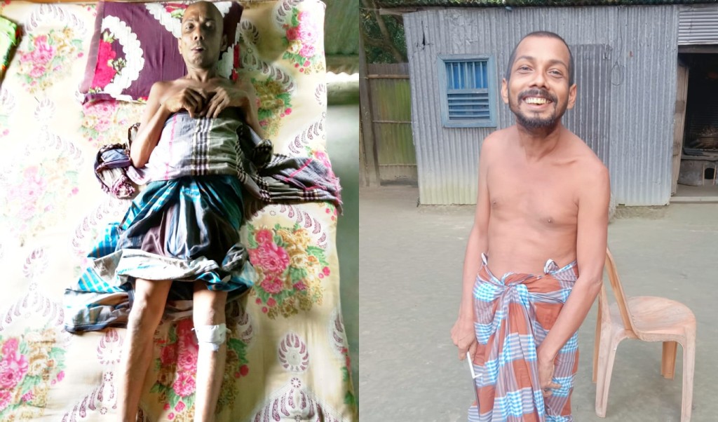 সুপারি গাছের পাতা নেওয়ায় প্রতিবন্ধীকে নির্মমভাবে পেটালেন প্রতিবেশী 4 প্রতিবন্ধী
