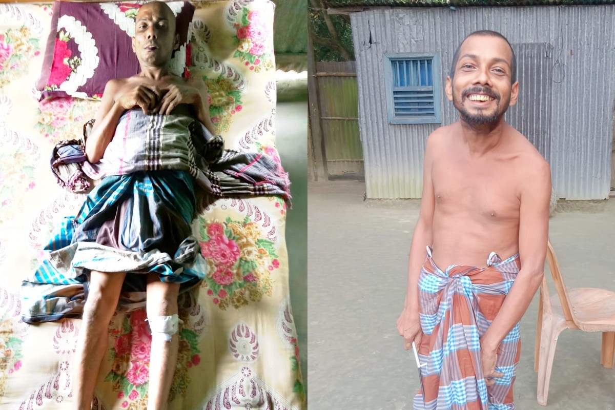 প্রতিবন্ধী