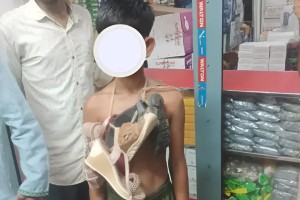 চুরির অভিযোগে শিশুর গলায় জুতার মালা, ছবি ভাইরাল