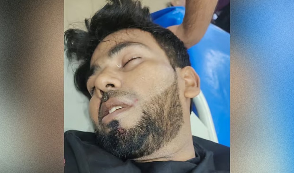 নোয়াখালীতে চাঁদা না পেয়ে প্রবাসীকে কুপিয়ে আঙুল বিচ্ছিন্ন 4 নোয়াখালীতে চাঁদা না পেয়ে প্রবাসীকে কুপিয়ে আঙুল বিচ্ছিন্ন 1755352900 নোয়াখালীতে চাঁদা না পেয়ে প্রবাসীকে কুপিয়ে আঙুল বিচ্ছিন্ন