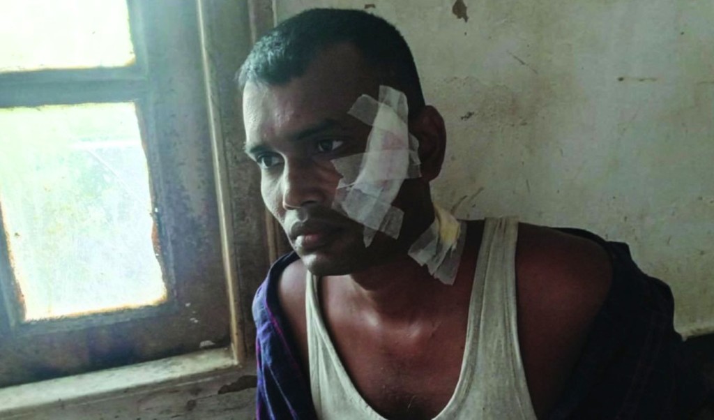 পাবনায় কৃষককে কুপিয়ে হত্যাচেষ্টার অভিযোগ 4 পাবনায় হত্যা চেষ্টা 1755750074 পাবনায় কৃষককে কুপিয়ে হত্যাচেষ্টার অভিযোগ