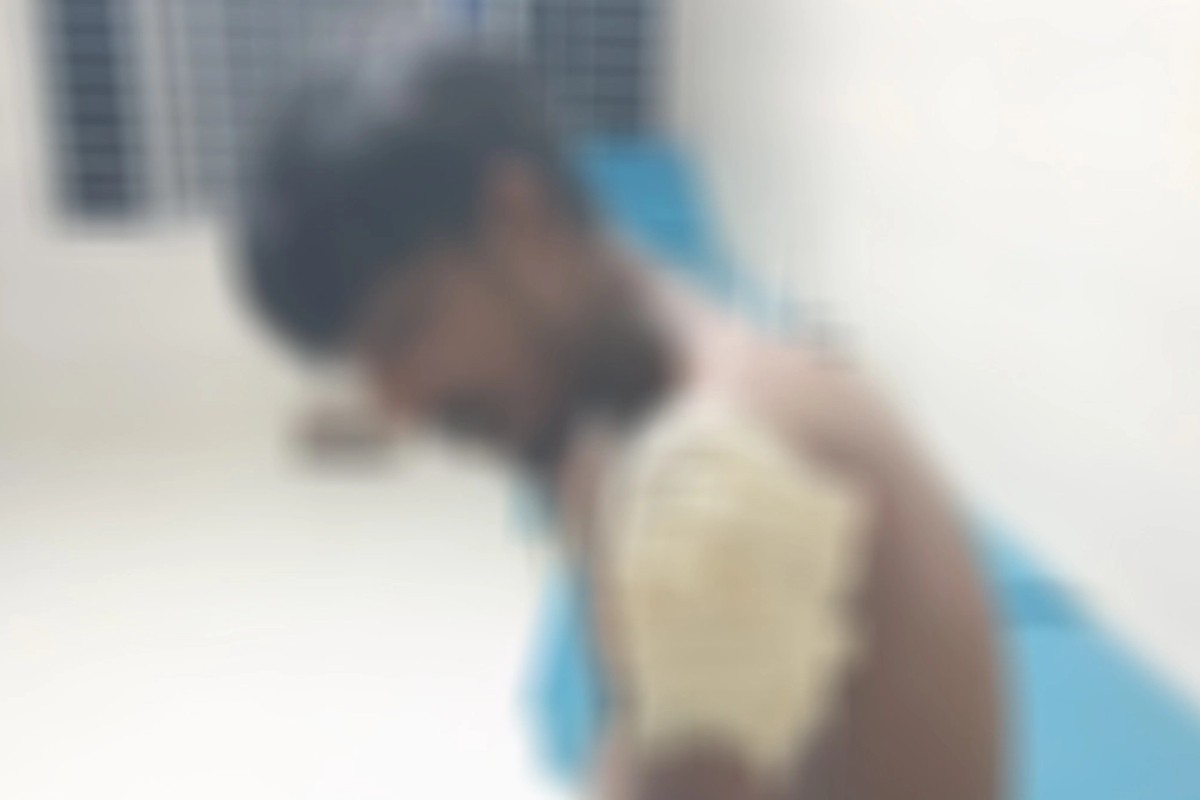 বগুড়ায় একে অপরের ছুরিকাঘাতে ২ বন্ধু আহত