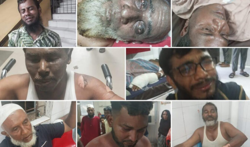 চট্টগ্রামে ওয়ার্কশপে হাইড্রোলিক জ্যাক বিস্ফোরণ, দগ্ধ ৮ 4 Add a subheading 2025 09 28T011208.325 1759000355 চট্টগ্রামে ওয়ার্কশপে হাইড্রোলিক জ্যাক বিস্ফোরণ, দগ্ধ ৮