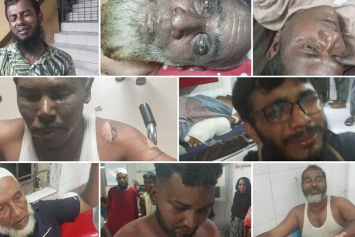 চট্টগ্রামে ওয়ার্কশপে হাইড্রোলিক জ্যাক বিস্ফোরণ, দগ্ধ ৮
