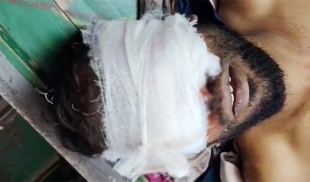 উপড়ে ফেলা হলো অটোরিকশাচালকের চোখ, কাটা হলো চার হাত-পায়ের রগ 4 উপড়ে ফেলা হলো অটোরিকশাচালকের চোখ কাটা হলো চার হাত পায়ের রগ 1757158561 উপড়ে ফেলা হলো অটোরিকশাচালকের চোখ, কাটা হলো চার হাত-পায়ের রগ