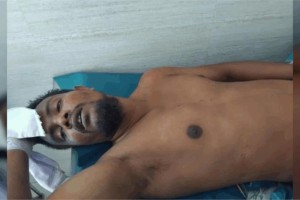 ঘুমের মধ্যে স্বামীর হাত-পা বেঁধে গোপনাঙ্গ কেটে দিলেন স্ত্রী