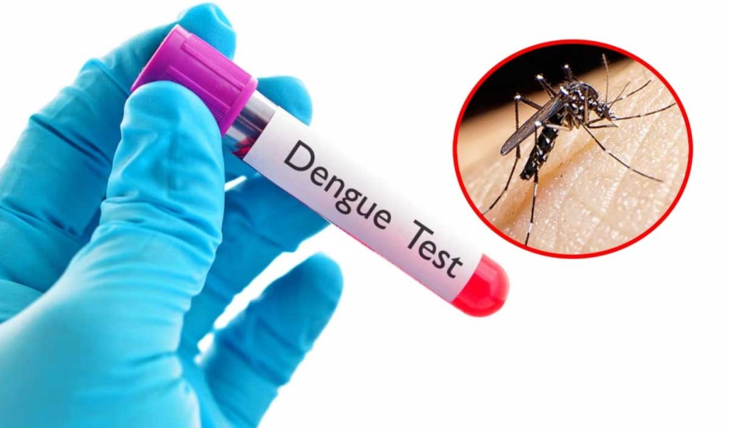 ডেঙ্গুতে আরও দুই জনের মৃত্যু, হাসপাতালে ৬২৫ জন 3 ডেঙ্গুতে আরও দুই জনের মৃত্যু হাসপাতালে ৬২৫ জন 1757511295 ডেঙ্গুতে আরও দুই জনের মৃত্যু, হাসপাতালে ৬২৫ জন