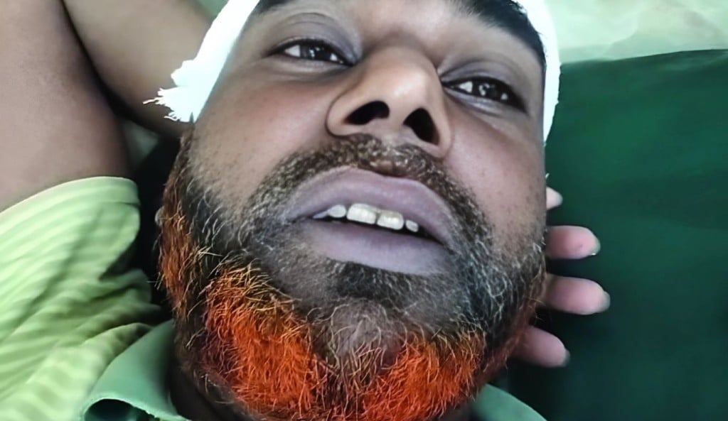 দুই ব্যবসায়ীকে পিটিয়ে পাঁচ লক্ষাধিক টাকা ছিনতাই 1756867926 দুই ব্যবসায়ীকে পিটিয়ে পাঁচ লক্ষাধিক টাকা ছিনতাই