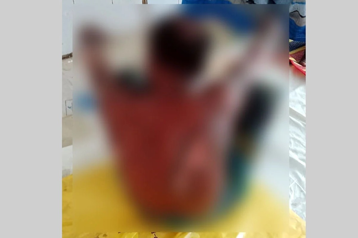 দুই সতীনের তুমুল ঝগড়ায় ঘরে আগুন, শিশুসহ দগ্ধ ৩