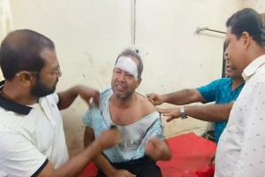 পটুয়াখালীতে আইনজীবীকে পিটিয়ে-কুপিয়ে জখম