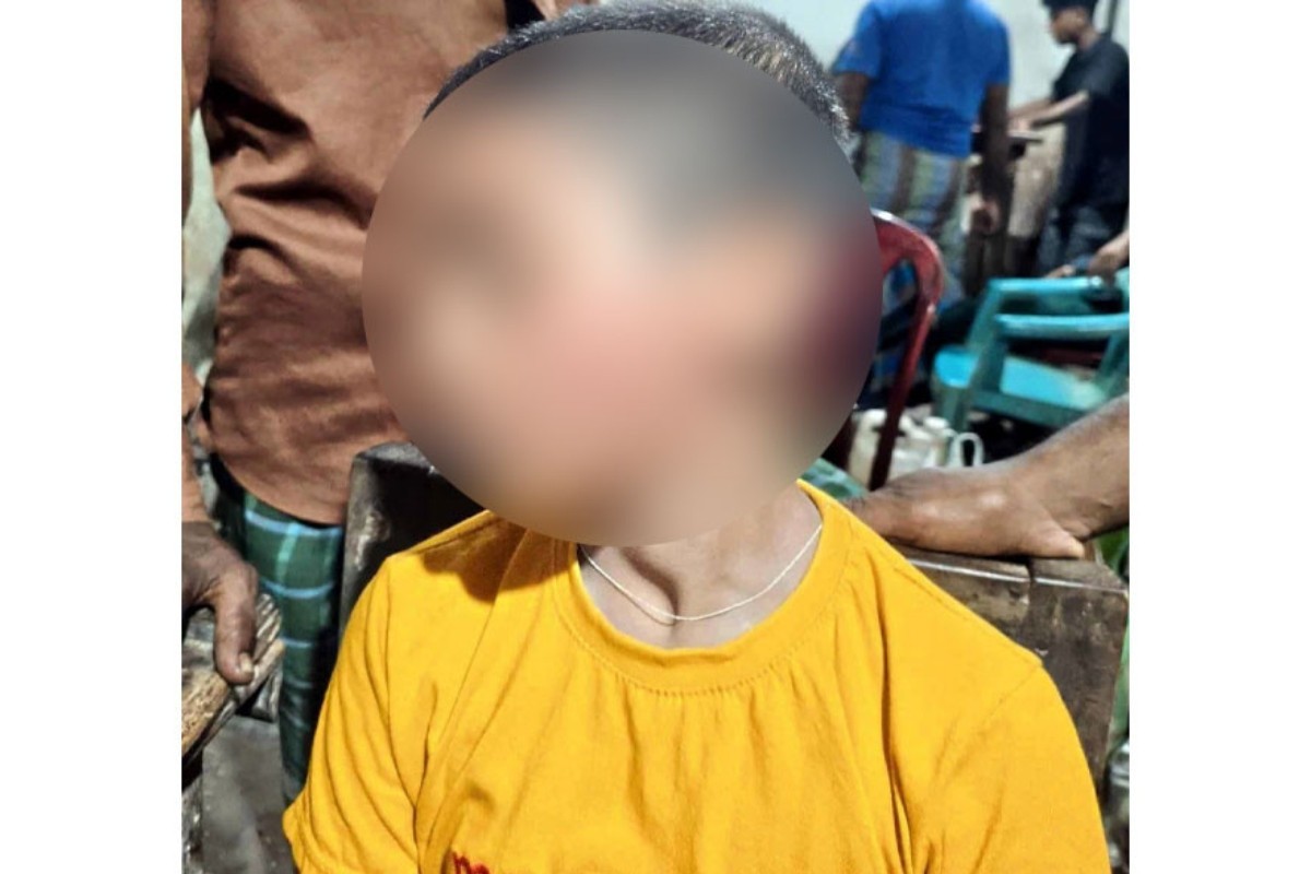 পরীক্ষার খাতায় কম নম্বরের কারণ জানতে চাওয়ায় স্কুলছাত্রকে মারধর