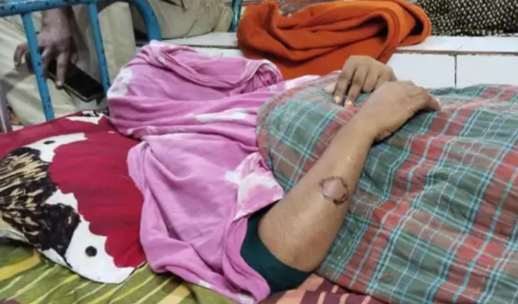 মামা শ্বশুরের কামড়ে গৃহবধূ হাসপাতালে 3 মামা শ্বশুরের কামড়ে গৃহবধূ হাসপাতালে 1758274555 মামা শ্বশুরের কামড়ে গৃহবধূ হাসপাতালে