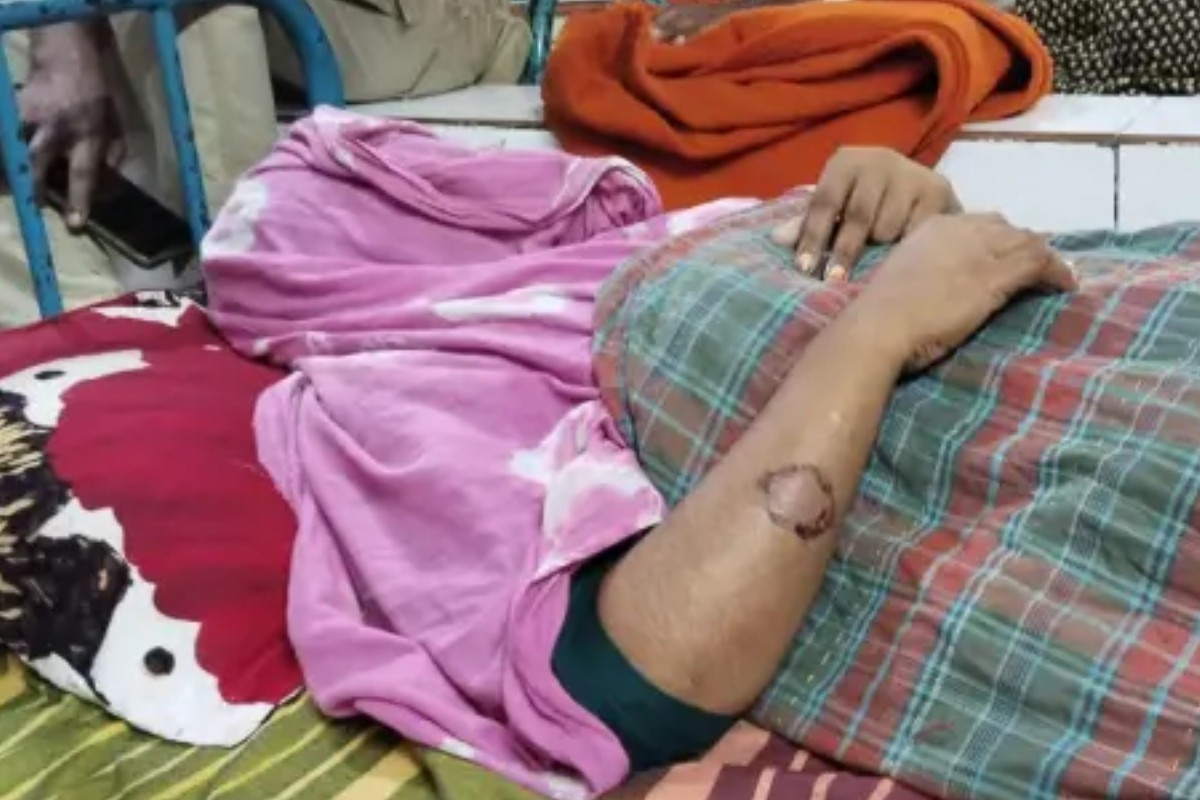 মামা শ্বশুরের কামড়ে গৃহবধূ হাসপাতালে