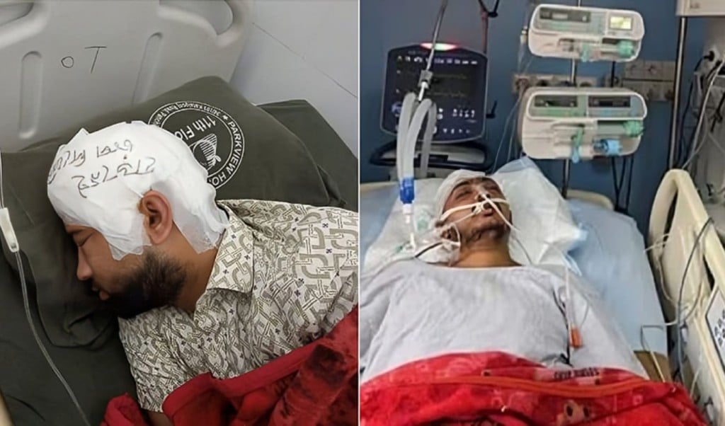 মামুনের মাথার খুলি ফ্রিজে রাখা এখনও জ্ঞান ফেরেনি সায়েমের 1756972057 চবিতে সংঘাত: মামুনের মাথার খুলি ফ্রিজে রাখা, এখনও জ্ঞান ফেরেনি সায়েমের