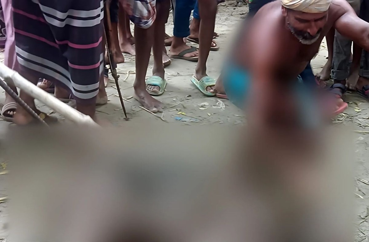 শিবগঞ্জে শূকরের কামড়ে আহত ৬