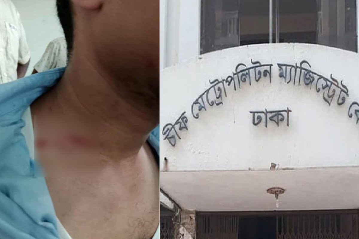 সিএমএম আদালতে সাংবাদিকের ওপর আইনজীবীদের হামলা
