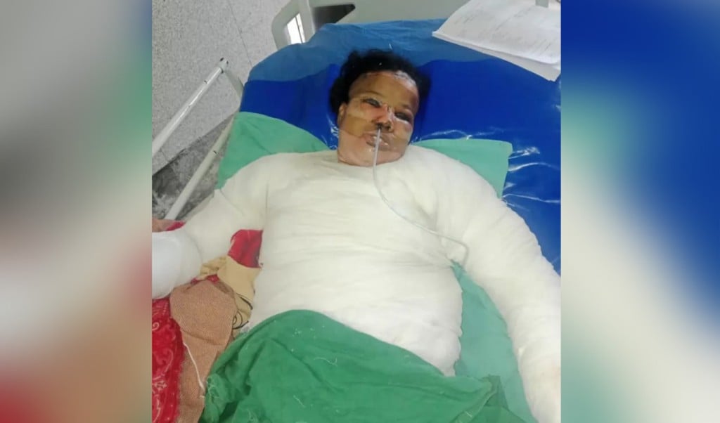 সুদের টাকা নিয়ে গৃহবধূকে পুড়িয়ে হত্যাচেষ্টা কারবারি আটক 1759044304 সুদের টাকা নিয়ে গৃহবধূকে পুড়িয়ে হত্যাচেষ্টা, কারবারি আটক