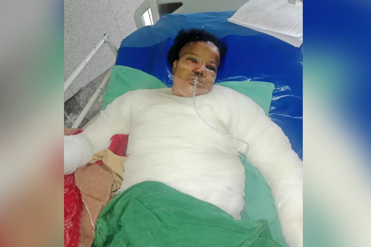 সুদের টাকা নিয়ে গৃহবধূকে পুড়িয়ে হত্যাচেষ্টা, কারবারি আটক