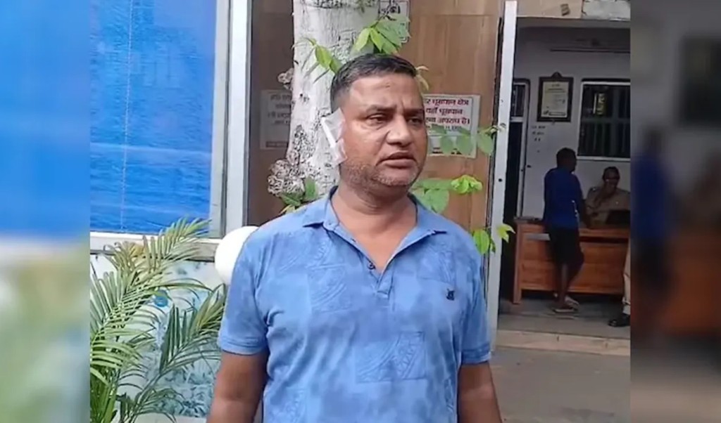 স্বামীর কান কামড়ে ছিঁড়ে নিলেন স্ত্রী 3 স্বামীর কান কামড়ে ছিঁড়ে নিলেন স্ত্রী 1758797546 স্বামীর কান কামড়ে ছিঁড়ে নিলেন স্ত্রী