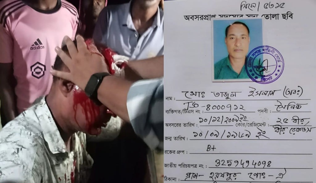 হরষপুরে বকেয়া ভাড়া চাওয়ায় হামলার শিকার সেনাবাহিনীর অবসরপ্রাপ্ত সদস্য 1758857639 হরষপুরে বকেয়া ভাড়া চাওয়ায় হামলার শিকার সেনাবাহিনীর অবসরপ্রাপ্ত সদস্য