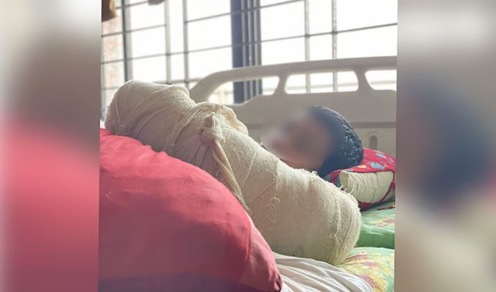 পিটিয়ে শিক্ষার্থীর হাত ভেঙে দিলেন মাদরাসা শিক্ষক 3 Untitled design 1761304768 পিটিয়ে শিক্ষার্থীর হাত ভেঙে দিলেন মাদরাসা শিক্ষক