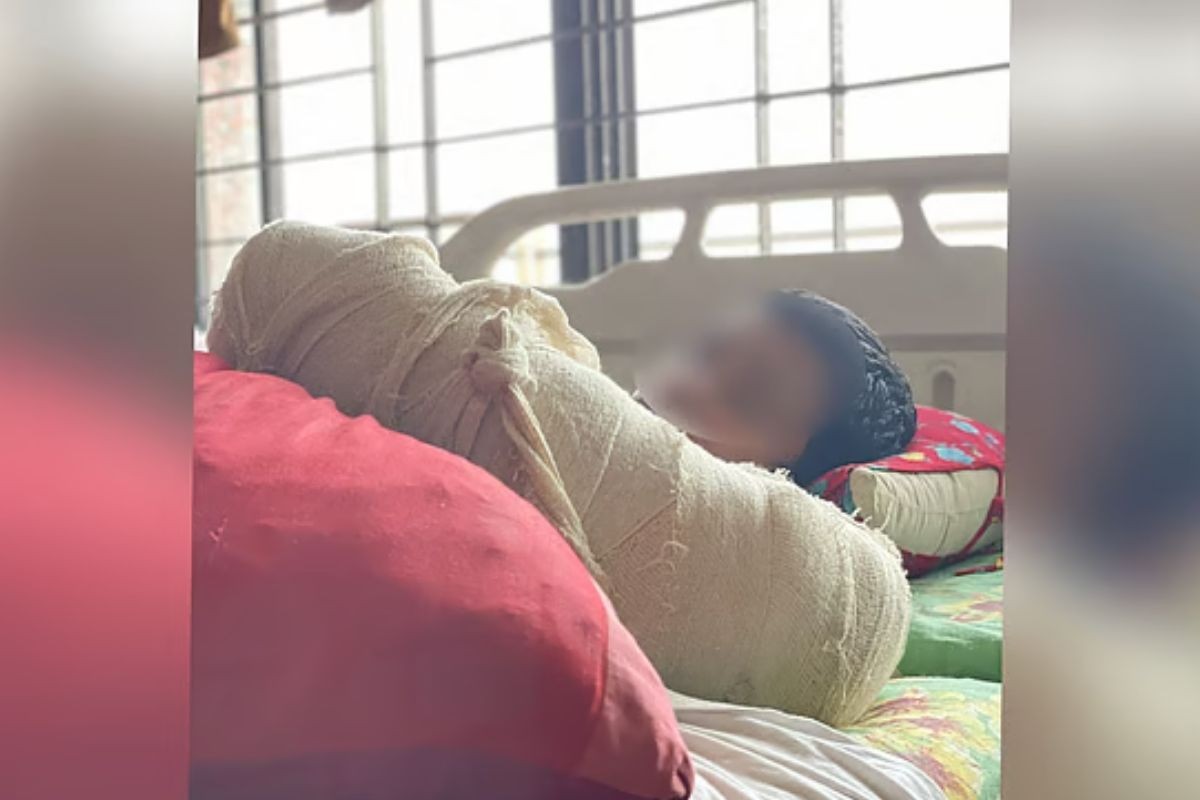 পিটিয়ে শিক্ষার্থীর হাত ভেঙে দিলেন মাদরাসা শিক্ষক