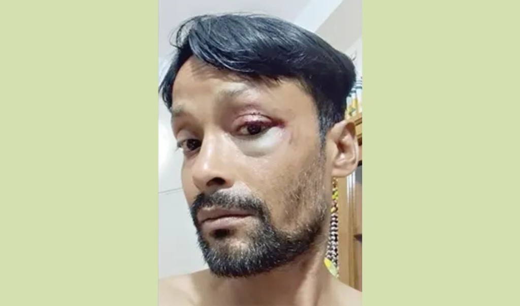 জুলাই ফাউন্ডেশনে জিজ্ঞাসাবাদের নামে জিআই পাইপ দিয়ে মারধর 3 aktar 1759720554 জুলাই ফাউন্ডেশনে জিজ্ঞাসাবাদের নামে জিআই পাইপ দিয়ে মারধর