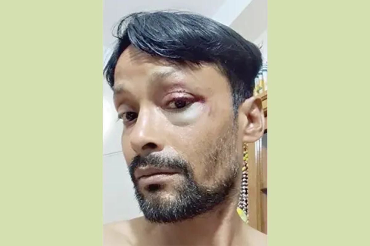 জুলাই ফাউন্ডেশনে জিজ্ঞাসাবাদের নামে জিআই পাইপ দিয়ে মারধর