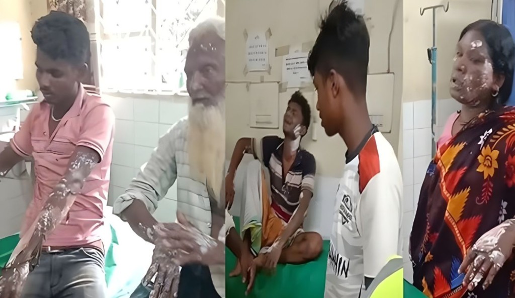 গ্যাসের বেলুন বিস্ফোরণে দগ্ধ ৭ 3 গ্যাসের বেলুন বিস্ফোরণে দগ্ধ ৭ 1760088281 গ্যাসের বেলুন বিস্ফোরণে দগ্ধ ৭