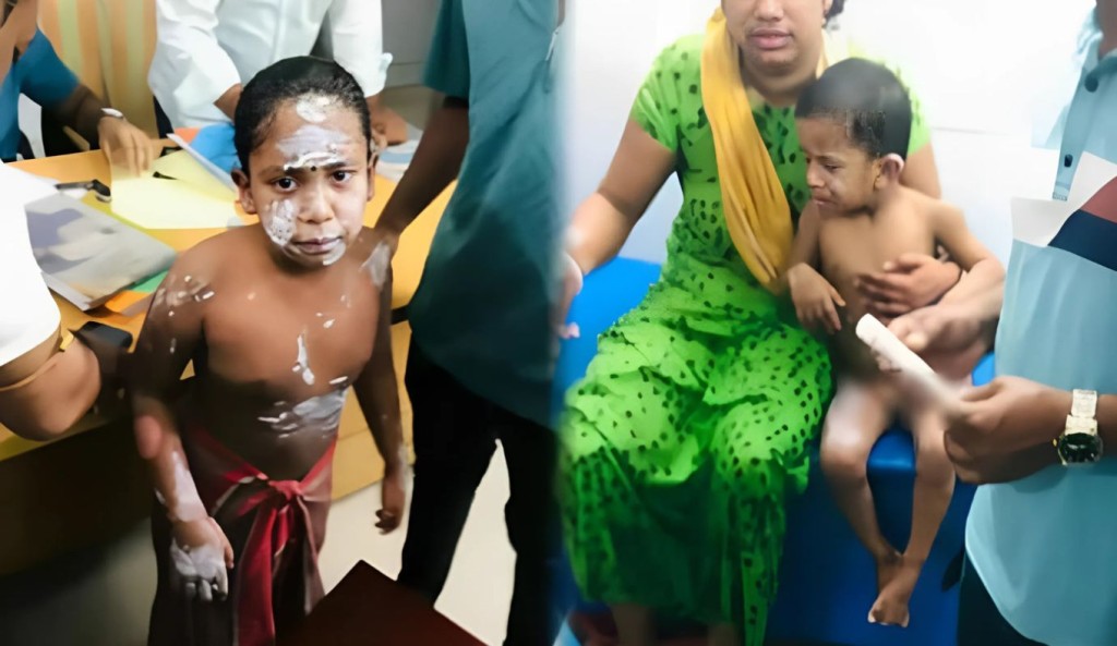 গ্যাসের লিকেজ থেকে বিস্ফোরণে একই পরিবারের শিশুসহ দগ্ধ ৪ 3 গ্যাসের লিকেজ বিস্ফোরণে একই পরিবারের শিশুসহ দগ্ধ ৪ 1759371283 গ্যাসের লিকেজ থেকে বিস্ফোরণে একই পরিবারের শিশুসহ দগ্ধ ৪