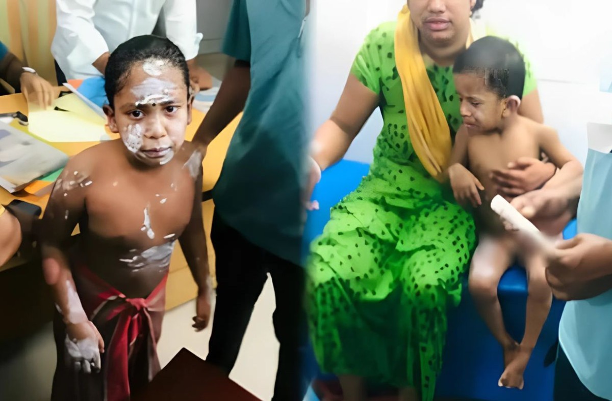 গ্যাসের লিকেজ থেকে বিস্ফোরণে একই পরিবারের শিশুসহ দগ্ধ ৪