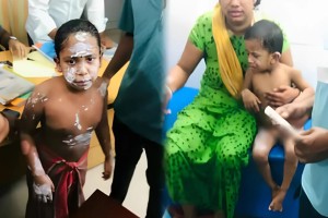 গ্যাসের লিকেজ থেকে বিস্ফোরণে একই পরিবারের শিশুসহ দগ্ধ ৪