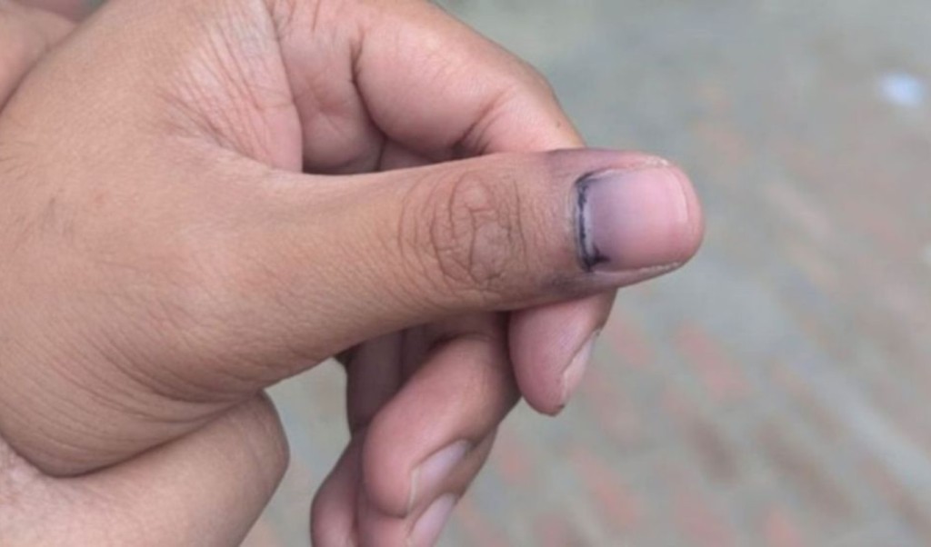 ঘষাঘষি না করলে কালি উঠবে না: রাবি উপাচার্য 4 ঘষাঘষি না করলে কালি উঠবে না রাবি উপাচার্য 1760607443 ঘষাঘষি না করলে কালি উঠবে না: রাবি উপাচার্য