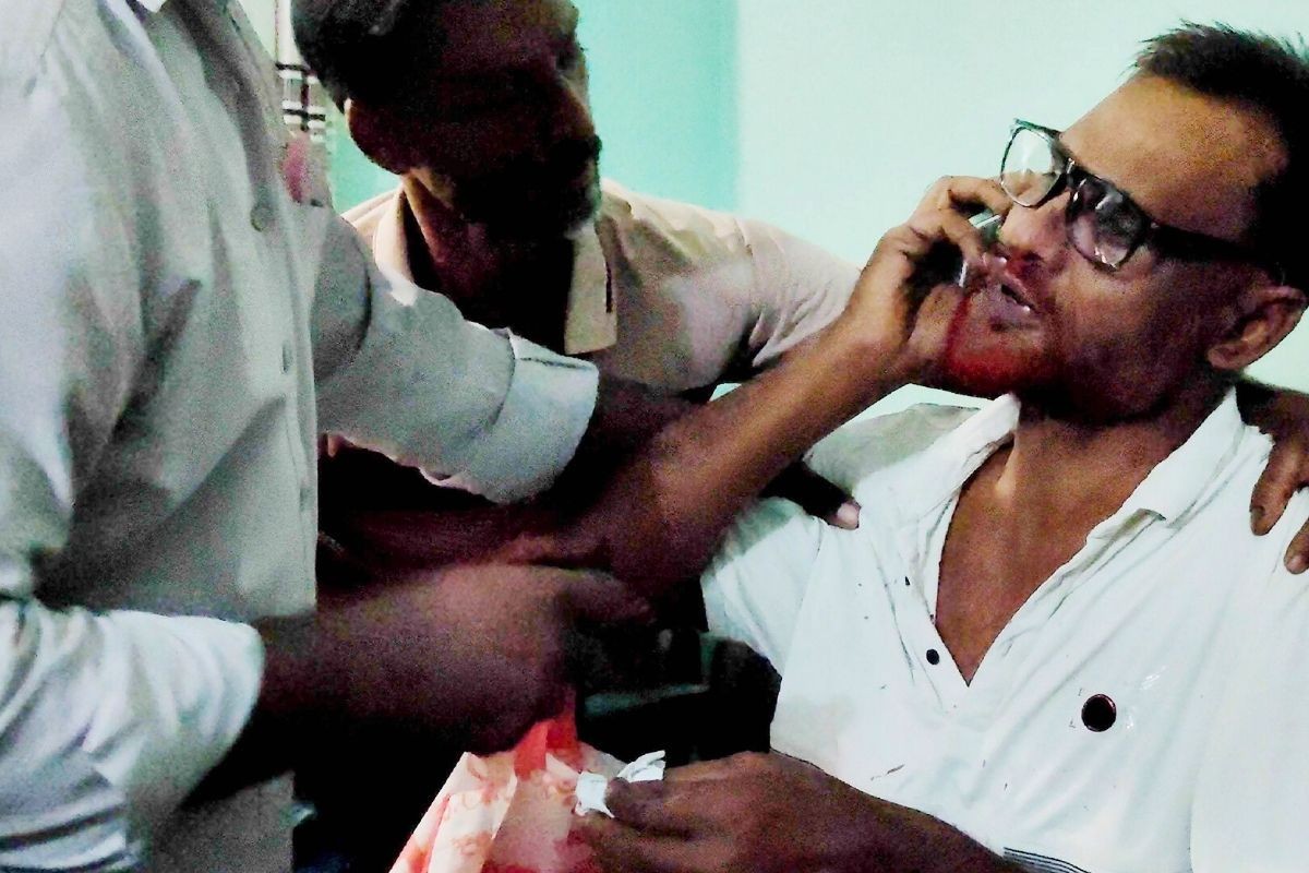 ঘুষি মেরে মেম্বারের নাক ফাটালেন আরেক মেম্বার