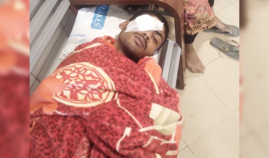 মুক্তিপণ না পেয়ে কলেজছাত্রের চোখ উপড়ে ফেলল দুর্বৃত্তরা 3 মুক্তিপণ না পেয়ে কলেজছাত্রের চোখ উপড়ে ফেলল দুর্বৃত্তরা 1761491999 মুক্তিপণ না পেয়ে কলেজছাত্রের চোখ উপড়ে ফেলল দুর্বৃত্তরা