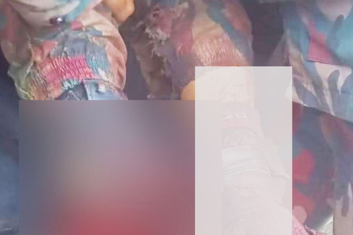 স্থলমাইন বিস্ফোরণে উড়ে গেল বিজিবি সদস্যের পা
