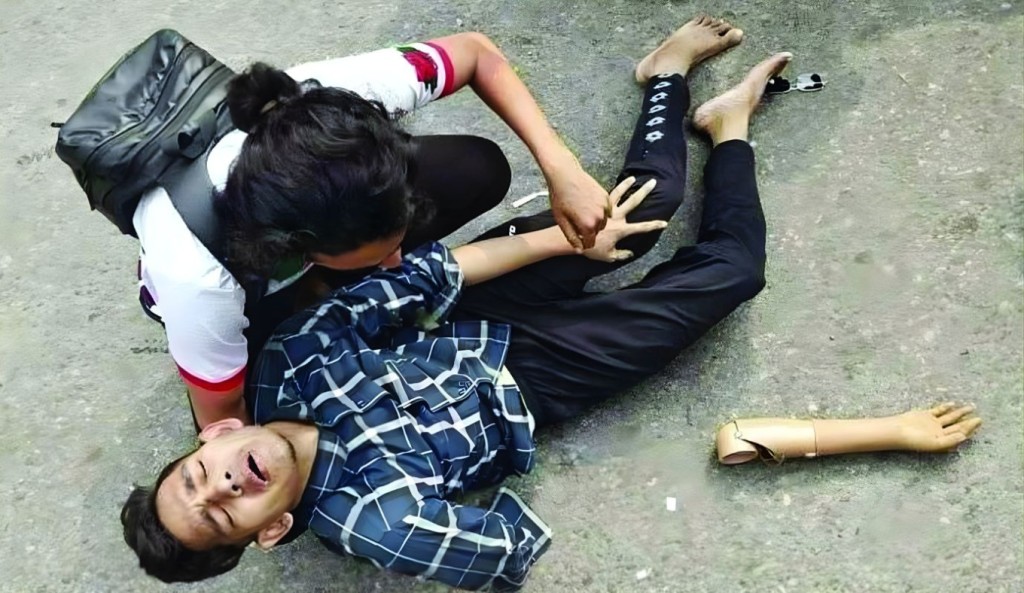 ‘আমার এক হাত নাই, কৃত্রিম হাত, এটাও ওরা ভেঙে ফেলেছে’ 3 ‘আমার এক হাত নাই কৃত্রিম হাত এটাও ওরা ভেঙে ফেলেছে 1760759568 ‘আমার এক হাত নাই, কৃত্রিম হাত, এটাও ওরা ভেঙে ফেলেছে’