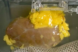 ‘সর্বজনীন’ কিডনি আবিষ্কার, হাজারো রোগীর জন্য নতুন আশা