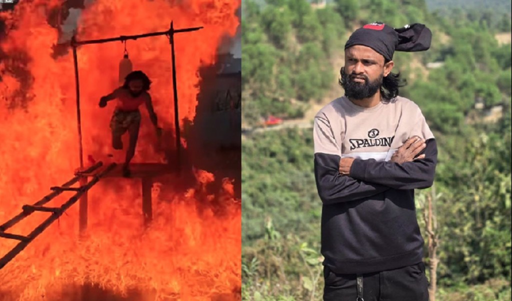 Burnt during petrol stunt Al Amin now in BIRDEM 1764496208 পেট্রল কনটেন্টে দগ্ধ আল আমিন বারডেমে
