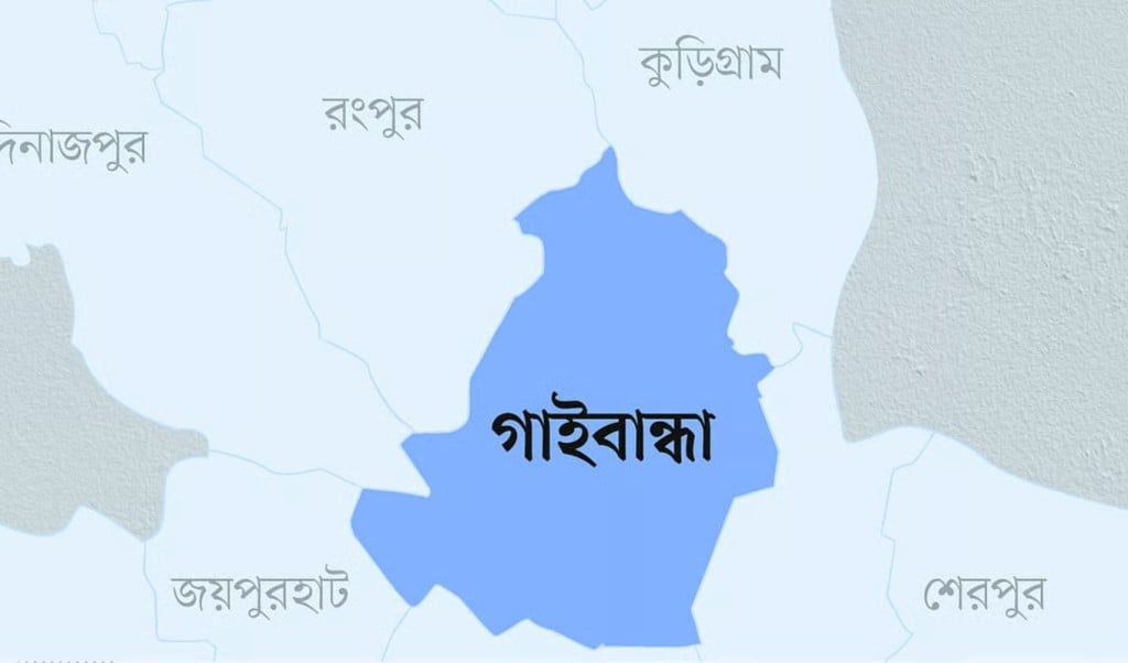 গাইবান্ধায় স্ত্রীর মুখে গরম রডের ছ্যাঁকা গোড়ালি কেটে দিল স্বামী 1762848985 গাইবান্ধায় স্ত্রীর মুখে গরম রডের ছ্যাঁকা, গোড়ালি কেটে দিল স্বামী