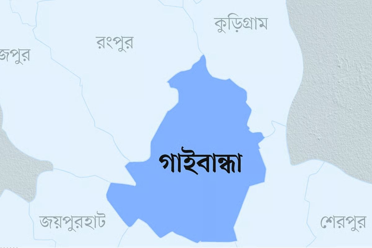 গাইবান্ধায় স্ত্রীর মুখে গরম রডের ছ্যাঁকা, গোড়ালি কেটে দিল স্বামী