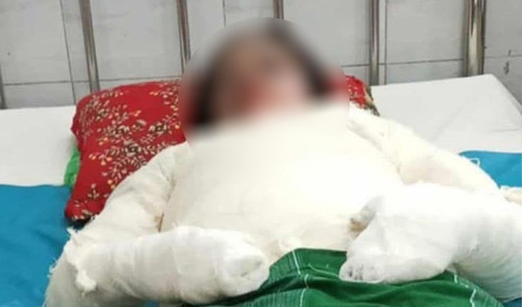 গৃহবধূকে আগুনে পুড়িয়ে হত্যার অভিযোগ, স্বামীসহ শ্বশুরবাড়ির সবাই পলাতক 3 গৃহবধূকে আগুনে পুড়িয়ে হত্যার অভিযোগ স্বামীসহ শ্বশুরবাড়ির সবাই পলাতক 1762072980 গৃহবধূকে আগুনে পুড়িয়ে হত্যার অভিযোগ, স্বামীসহ শ্বশুরবাড়ির সবাই পলাতক