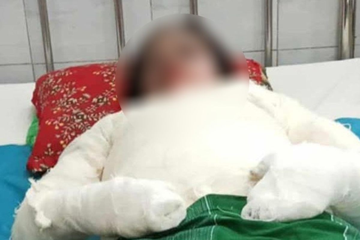 গৃহবধূকে আগুনে পুড়িয়ে হত্যার অভিযোগ, স্বামীসহ শ্বশুরবাড়ির সবাই পলাতক
